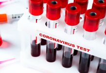 RS: Preminule tri osobe zaražene virusom korona, osam novih slučajeva