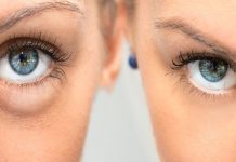 Šta vaši podočnjaci govore o vašem zdravlju? Ovo su signali koje ne smijete ignorisati