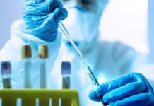 Čak i ako niste imali COVID-19, možete imati zabrinjavajuće posljedice