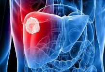 Novo istraživanje: Ovi napici povećavaju rizik od bolesti jetre i do 60 odsto