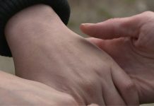 Zdravstveni problemi mogu se otkriti po rukama, kineski naučnici pojasnili kako