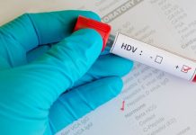 Hepatitis D često ostaje neotkriven, uprkos mogućnostima liječenja