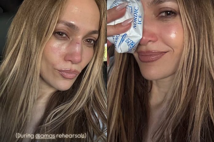 jlo
