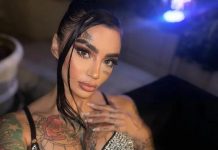 Poznata influenserka (31) preminula nakon plastične operacije u Turskoj