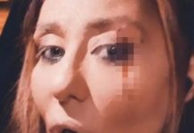 Ana Nikolić brutalno pretučena, pokazala jezive povrede na licu