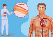 Ova jutarnja navika vremenom može povisiti holesterol