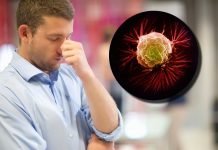 Da li stres stvarno izaziva rak: Naučnici razriješili dilemu