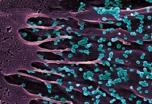 WHO upozorio na epidemiju virusa: Potrebna hitna akcija kako bi se spriječilo ponavljanje historije!