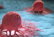 VAŽNO OTKRIĆE: Veza između jedne od najsmrtonosnijih vrsta raka i česte navike ljudi mogla bi promijeniti sve…