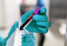 Nauka na pragu čuda: Novi test otkriva rak prije simptoma!?