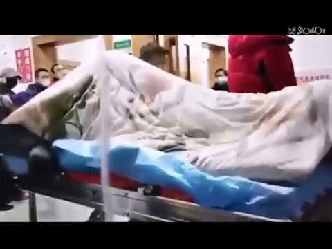 UZNEMIRUJUĆI VIDEO SNIMAK: Ovako izgleda čovjek obolio od koronavirusa – groznica, napadi i konvulzije