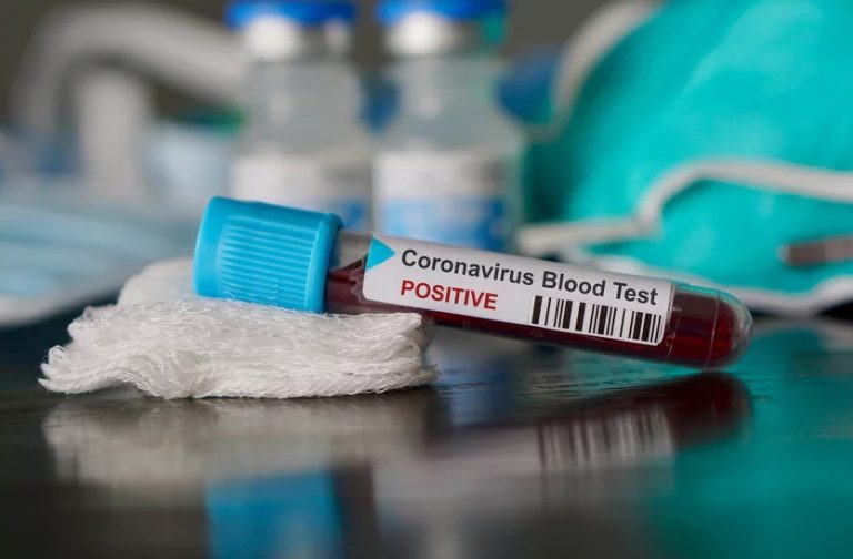 Pronađeni novi dokazi da novi koronavirus potiče od slijepih miševa