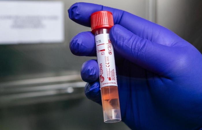 Osam pripadnika OSBiH pozitivno na koronavirus, 90 vojnih lica u samoizolaciji