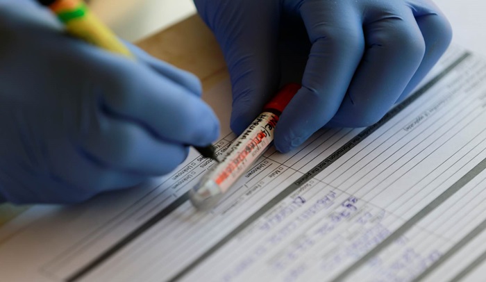 Crna Gora: Koronavirusom zaraženo još 57 osoba, jedan smrtni slučaj