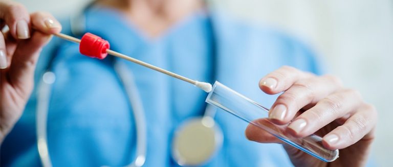 U BiH registrovana nova 172 slučaja koronavirusa