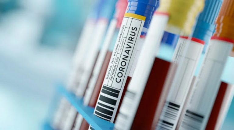 U RS 323 novozaraženih koronavirusom, pet osoba preminulo