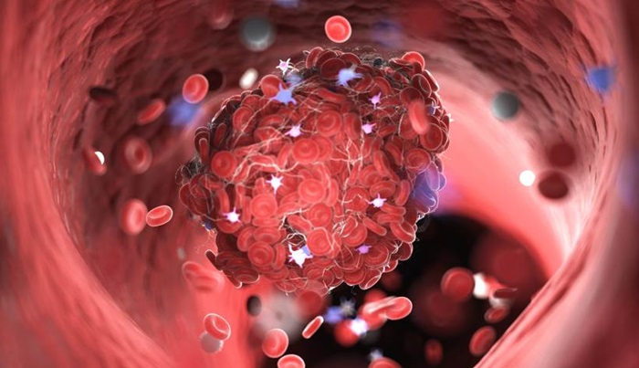 Tri popularna dodatka mogu povećati rizik od krvnih ugrušaka