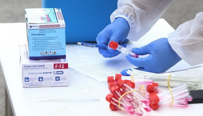 U RS 54 nova slučaja koronavirusa, tri osobe preminule