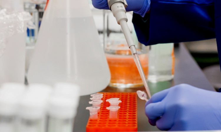 Korona u BiH: 73 umrlih i 726 novozaraženih