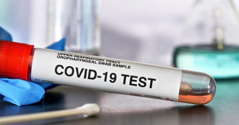 U KS potvrđeno 27 novih slučajeva zaraze koronavirusom