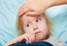 Epidemija u BiH ne jenjava: Gotovo 7.000 slučajeva zaraze morbilima!