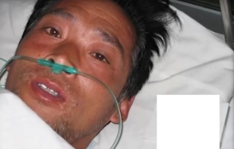 Čovjek koji je umro najbolnijom smrću ikad