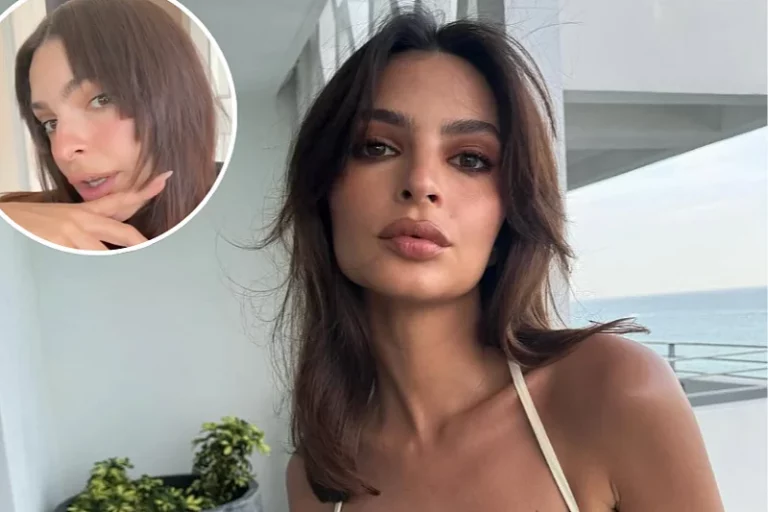 Emily Ratajkowski pokazala frizuru koju je nazvala najgorom u životu: “Imam šiške na potiljku”