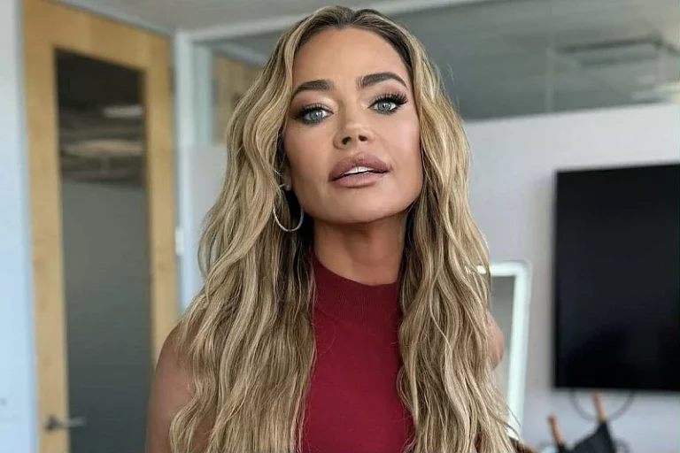 Denise Richards pokazala ogromnu masnicu na oku, navela da je muž pretukao: Šamarao me po licu