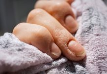 Evo kako prepoznati da vašem tijelu nedostaje proteina