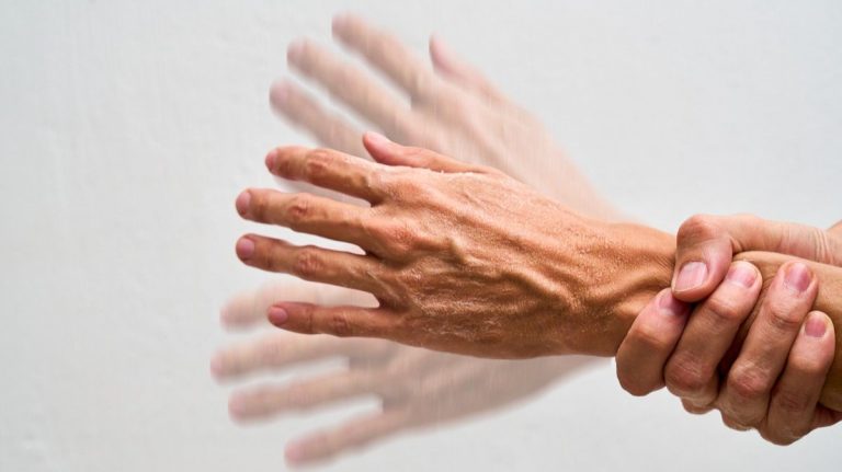 Ruke vam se nekontrolisano tresu: Evo šta odmah morate uraditi